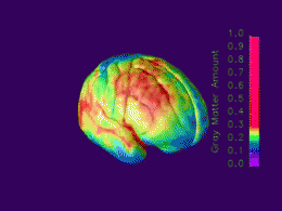 This animation, comprised of MRI scans, show changes in the brain between the ages of 5 and 20. Red indicates more grey matter and blue indicates less.